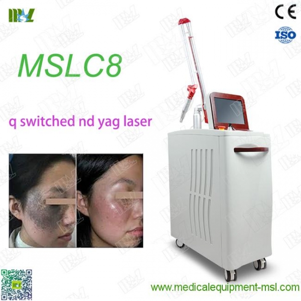 Q switch nd yag laser machine